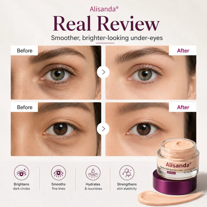 Last day Buy 1 Get 1 Free !✨Alisanda Calcium Dark Spot Eye Cream